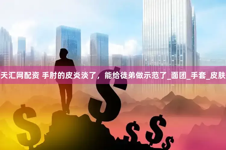 天汇网配资 手肘的皮炎淡了，能给徒弟做示范了_面团_手套_皮肤